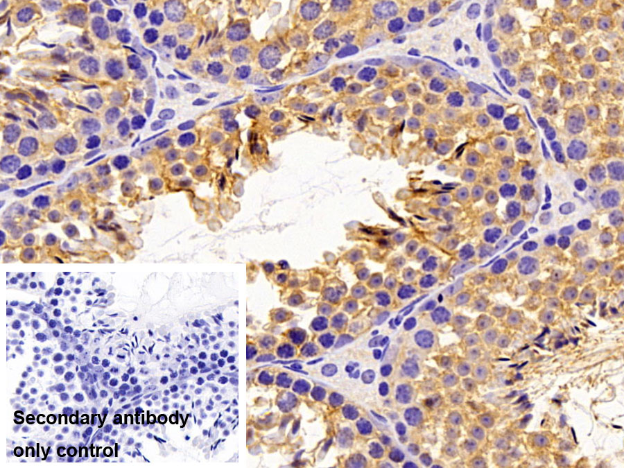 Polyclonal Antibody to Glutathione Peroxidase 4 (GPX4)