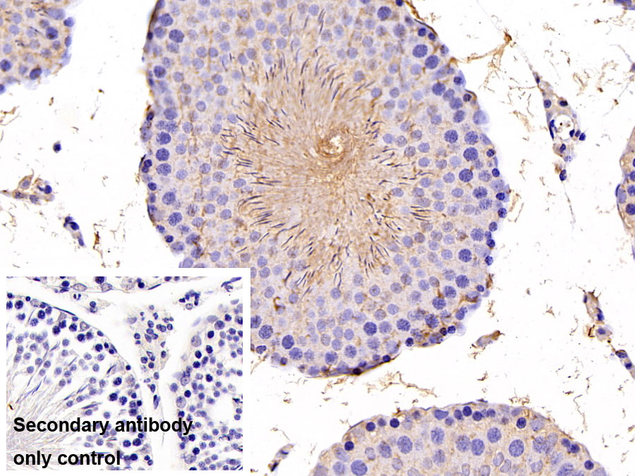 Polyclonal Antibody to Glutathione Peroxidase 4 (GPX4)