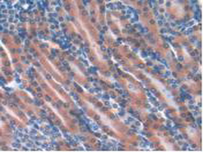 Polyclonal Antibody to Glutathione Peroxidase 4 (GPX4)