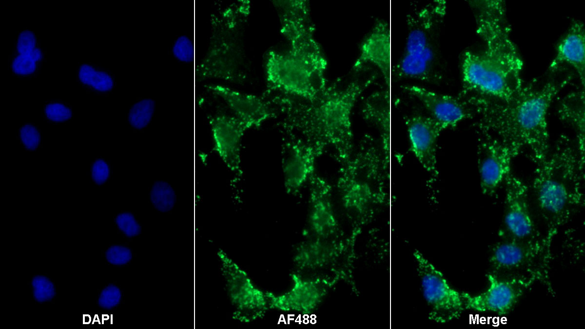 Polyclonal Antibody to Glutathione Peroxidase 4 (GPX4)