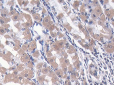 Polyclonal Antibody to Asparaginyl tRNA Synthetase (NARS)