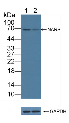 Polyclonal Antibody to Asparaginyl tRNA Synthetase (NARS)