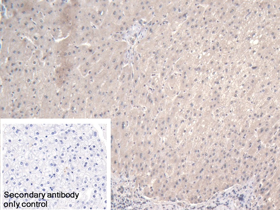 Polyclonal Antibody to Asparaginyl tRNA Synthetase (NARS)