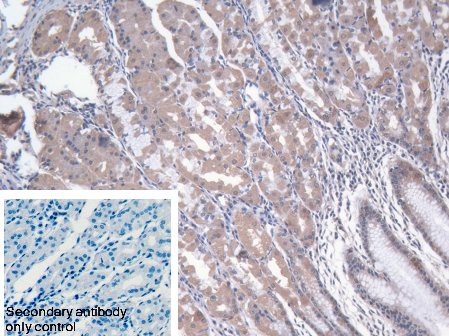 Polyclonal Antibody to Asparaginyl tRNA Synthetase (NARS)