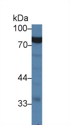 Polyclonal Antibody to Glycyl tRNA Synthetase (GARS)