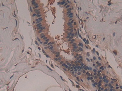 Polyclonal Antibody to Glycyl tRNA Synthetase (GARS)