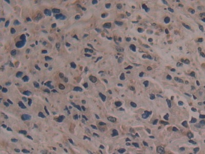 Polyclonal Antibody to Glycyl tRNA Synthetase (GARS)