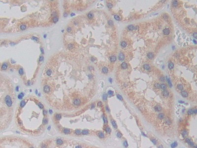 Polyclonal Antibody to Arginyl tRNA Synthetase (RARS)