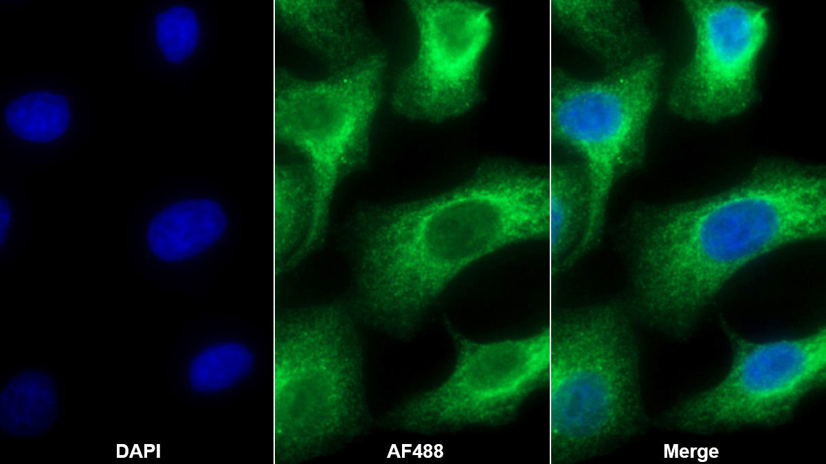 Polyclonal Antibody to Arginyl tRNA Synthetase (RARS)