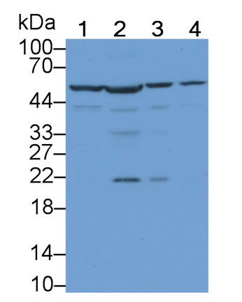 Polyclonal Antibody to Histidyl tRNA Synthetase (HARS)