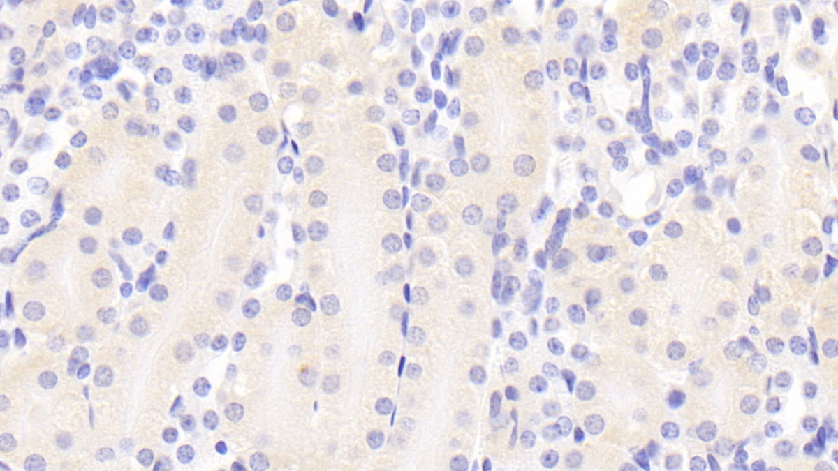 Polyclonal Antibody to Phenylalanyl tRNA Synthetase 2, Mitochondrial (FARS2)