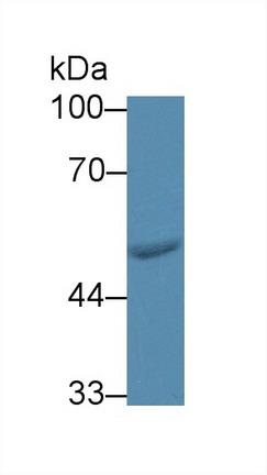 Polyclonal Antibody to Phenylalanyl tRNA Synthetase 2, Mitochondrial (FARS2)