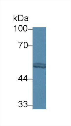 Polyclonal Antibody to Phenylalanyl tRNA Synthetase 2, Mitochondrial (FARS2)