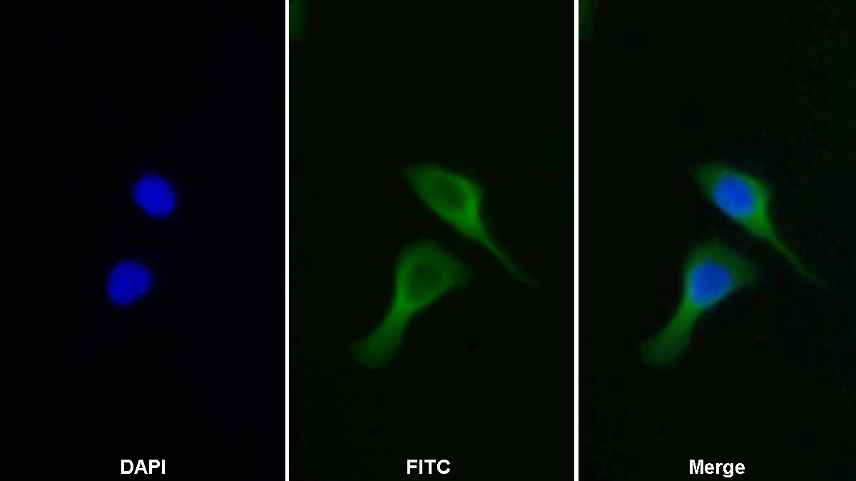 Polyclonal Antibody to Phenylalanyl tRNA Synthetase 2, Mitochondrial (FARS2)