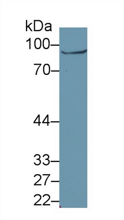 Polyclonal Antibody to Glutaminyl tRNA Synthetase (QARS)