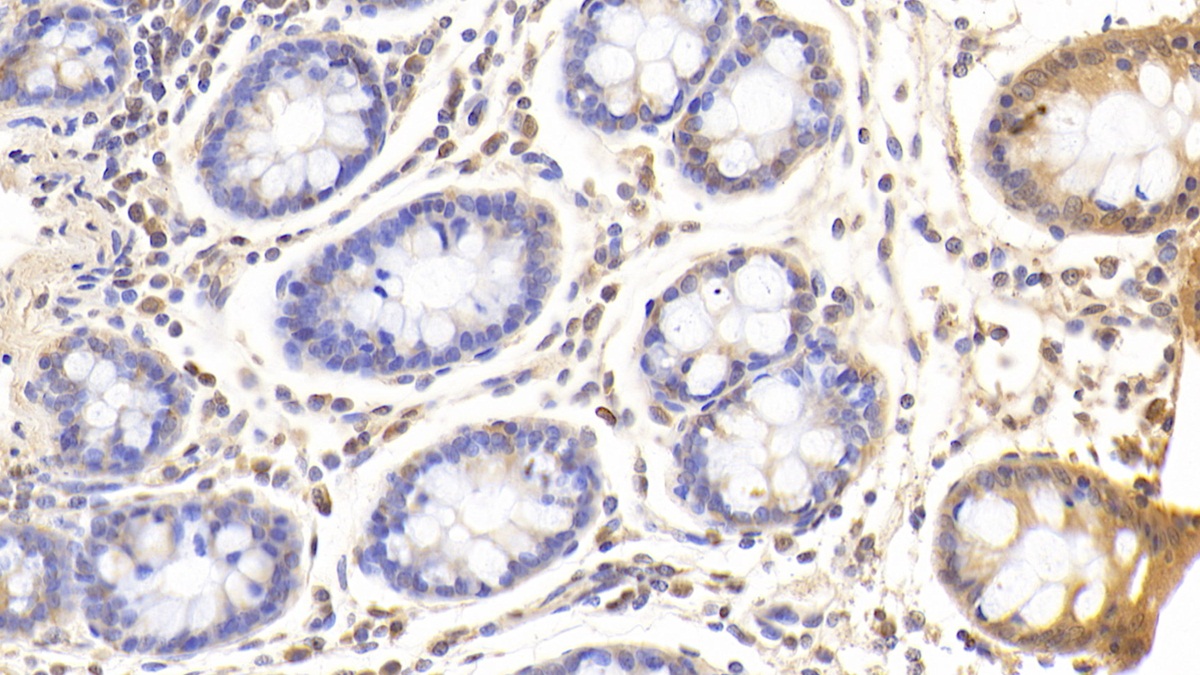 Polyclonal Antibody to Glutaminyl tRNA Synthetase (QARS)