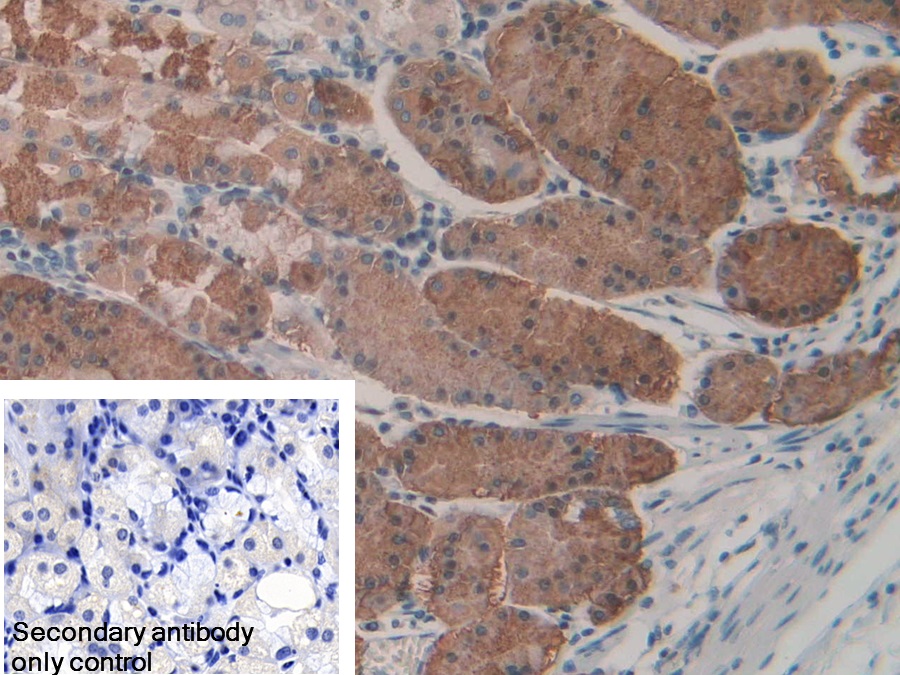 Polyclonal Antibody to Lysyl tRNA Synthetase (KARS)