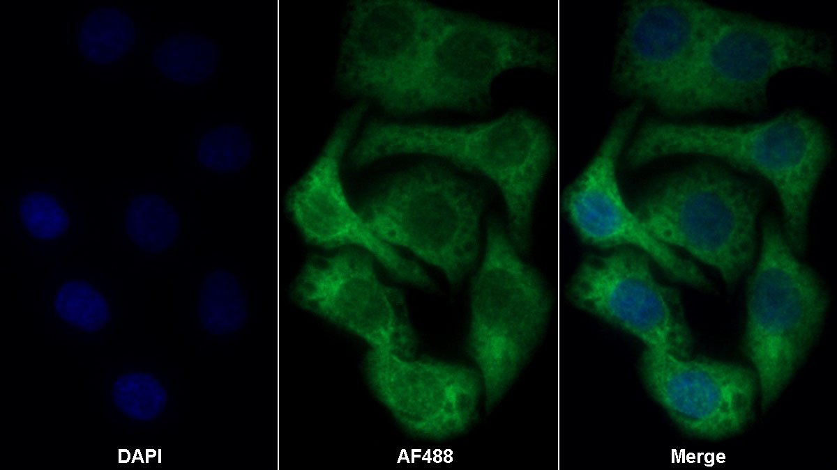 Polyclonal Antibody to Lysyl tRNA Synthetase (KARS)