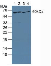 Polyclonal Antibody to Tyrosyl tRNA Synthetase (YARS)