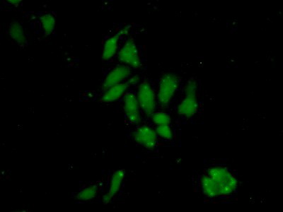 Polyclonal Antibody to Tyrosyl tRNA Synthetase (YARS)