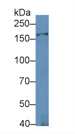 Polyclonal Antibody to Isoleucyl tRNA Synthetase (IARS)