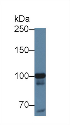 Polyclonal Antibody to Methionyl tRNA Synthetase (MARS)