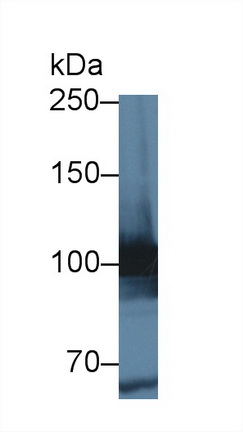 Polyclonal Antibody to Methionyl tRNA Synthetase (MARS)