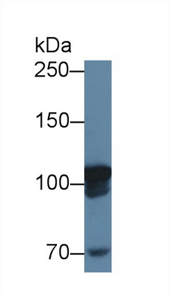 Polyclonal Antibody to Methionyl tRNA Synthetase (MARS)