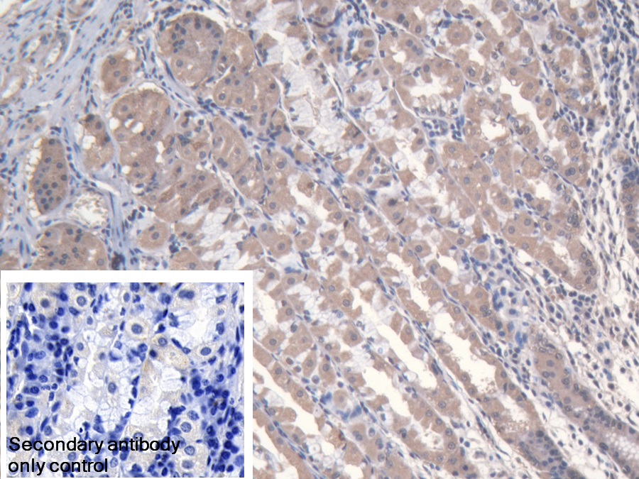 Polyclonal Antibody to Methionyl tRNA Synthetase (MARS)