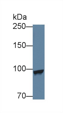 Polyclonal Antibody to Methionyl tRNA Synthetase (MARS)