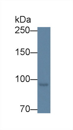 Polyclonal Antibody to Methionyl tRNA Synthetase (MARS)