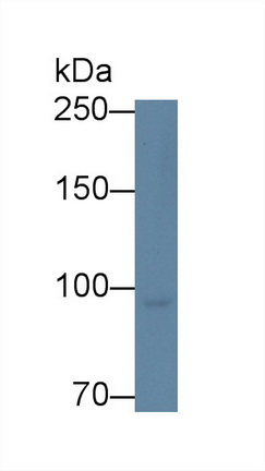 Polyclonal Antibody to Methionyl tRNA Synthetase (MARS)