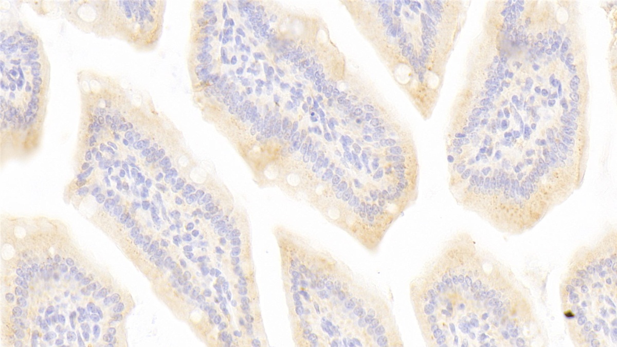 Polyclonal Antibody to Methionyl tRNA Synthetase (MARS)