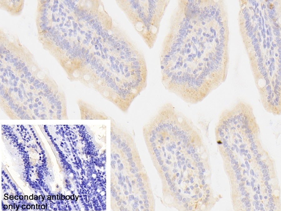 Polyclonal Antibody to Methionyl tRNA Synthetase (MARS)