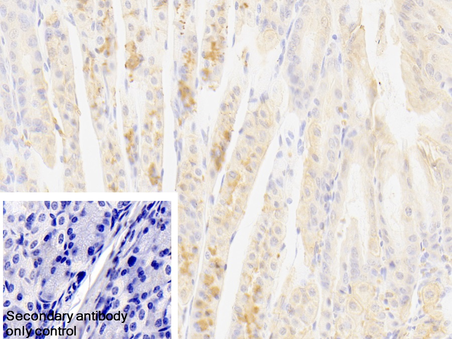 Polyclonal Antibody to Methionyl tRNA Synthetase (MARS)