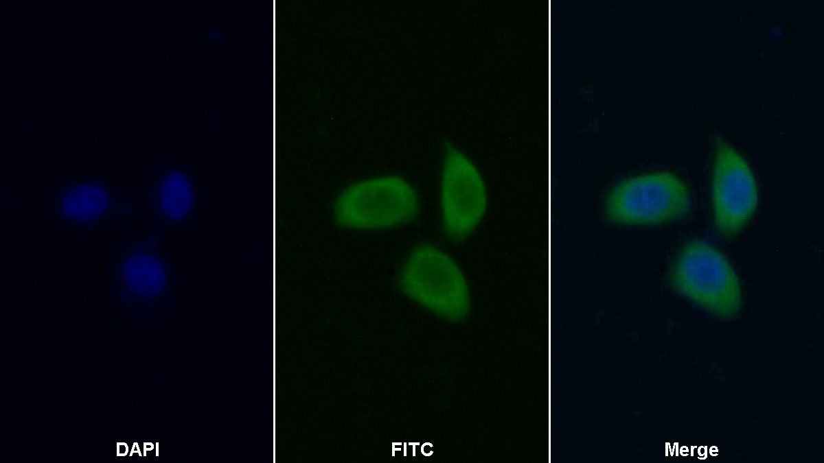 Polyclonal Antibody to Methionyl tRNA Synthetase (MARS)