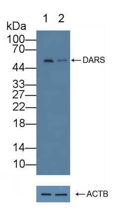 Polyclonal Antibody to Aspartyl tRNA Synthetase (DARS)