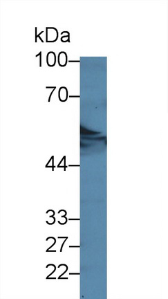 Polyclonal Antibody to Aspartyl tRNA Synthetase (DARS)