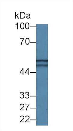 Polyclonal Antibody to Aspartyl tRNA Synthetase (DARS)