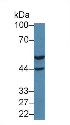 Polyclonal Antibody to Aspartyl tRNA Synthetase (DARS)