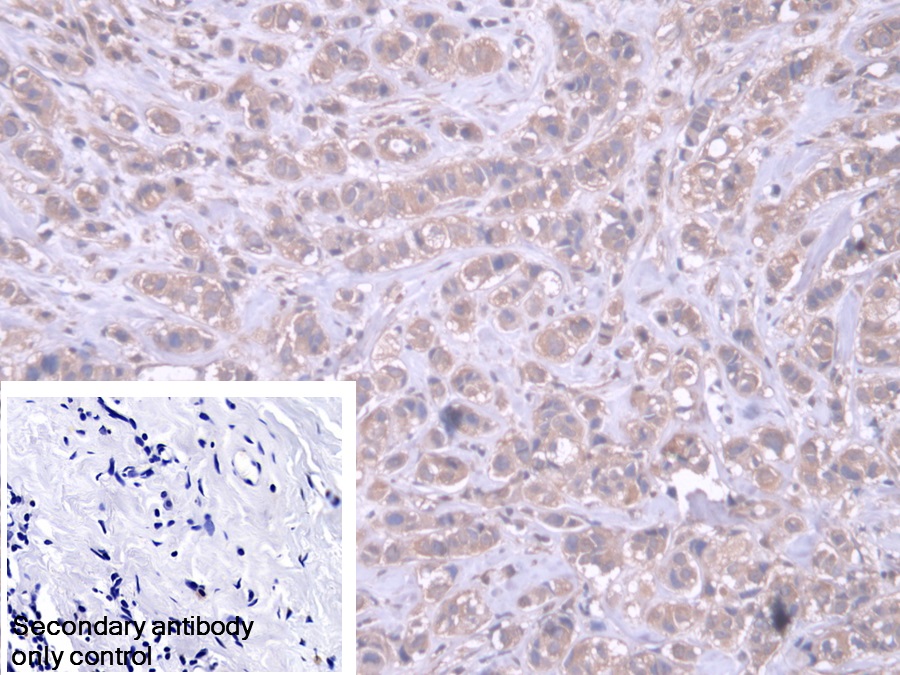 Polyclonal Antibody to Aspartyl tRNA Synthetase (DARS)