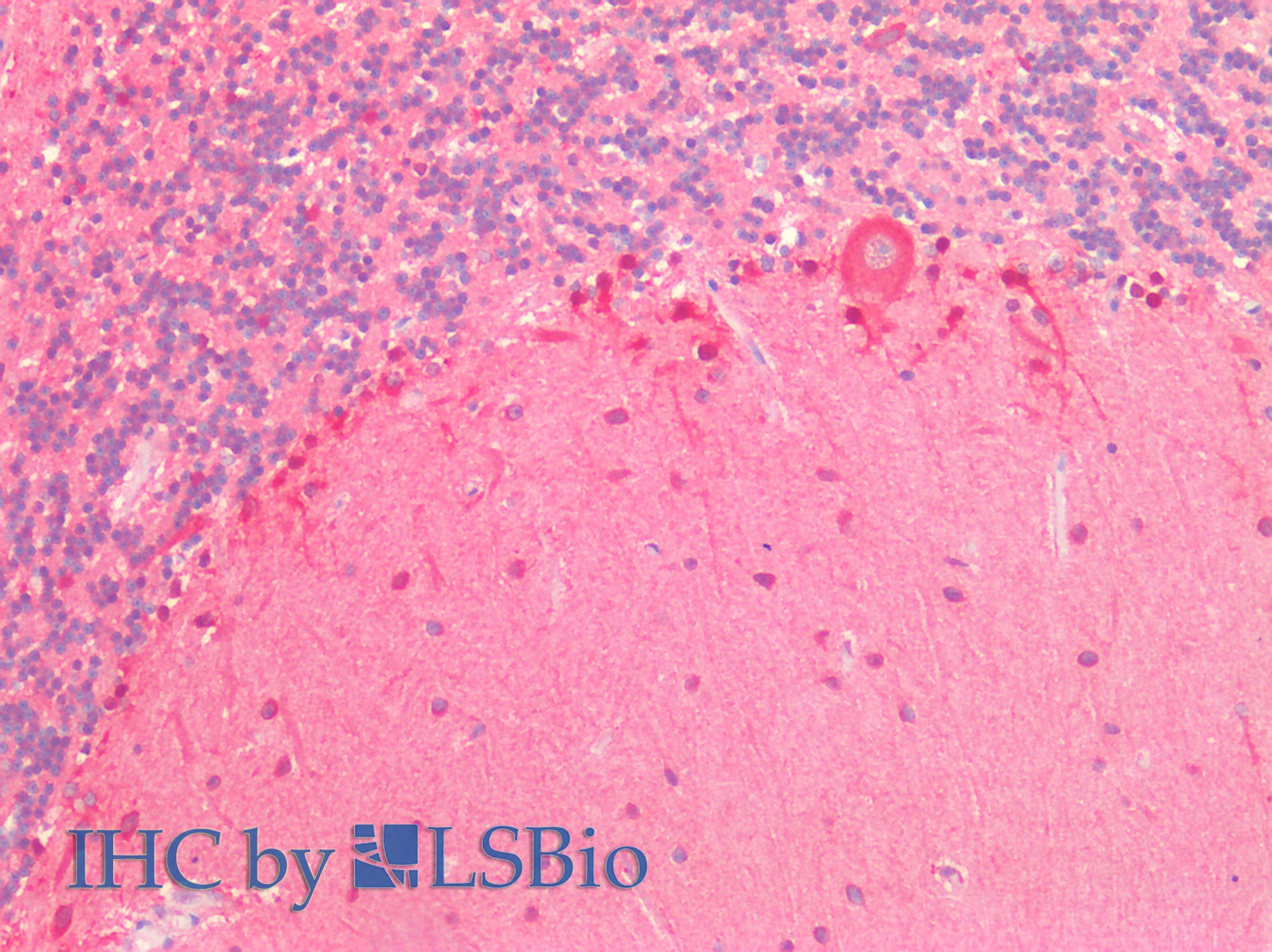 Polyclonal Antibody to Valyl tRNA Synthetase (VARS)