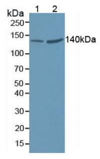 Polyclonal Antibody to Valyl tRNA Synthetase (VARS)