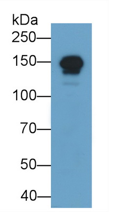 Polyclonal Antibody to Myosin Binding Protein C, Cardiac (MYBPC3)