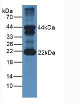 Polyclonal Antibody to Follicle Stimulating Hormone Beta (FSHb)