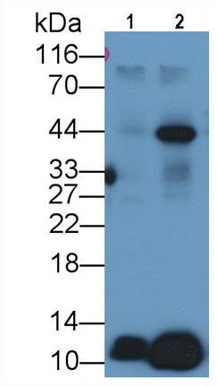 Polyclonal Antibody to Follicle Stimulating Hormone Beta (FSHb)