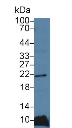 Polyclonal Antibody to Ferritin, Light Polypeptide (FTL)