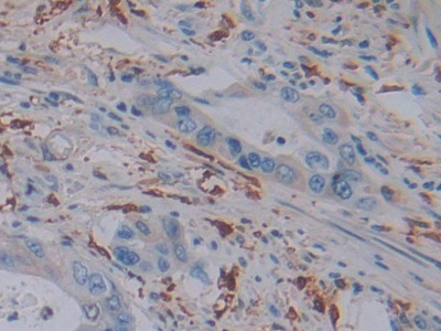 Polyclonal Antibody to Ferritin, Light Polypeptide (FTL)