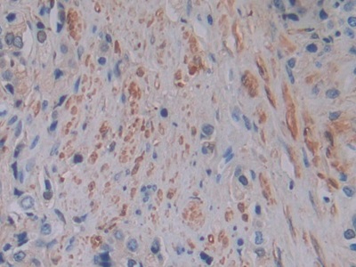 Polyclonal Antibody to Ferritin, Light Polypeptide (FTL)