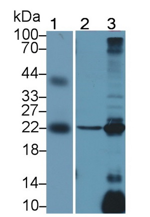 Polyclonal Antibody to Ferritin, Light Polypeptide (FTL)